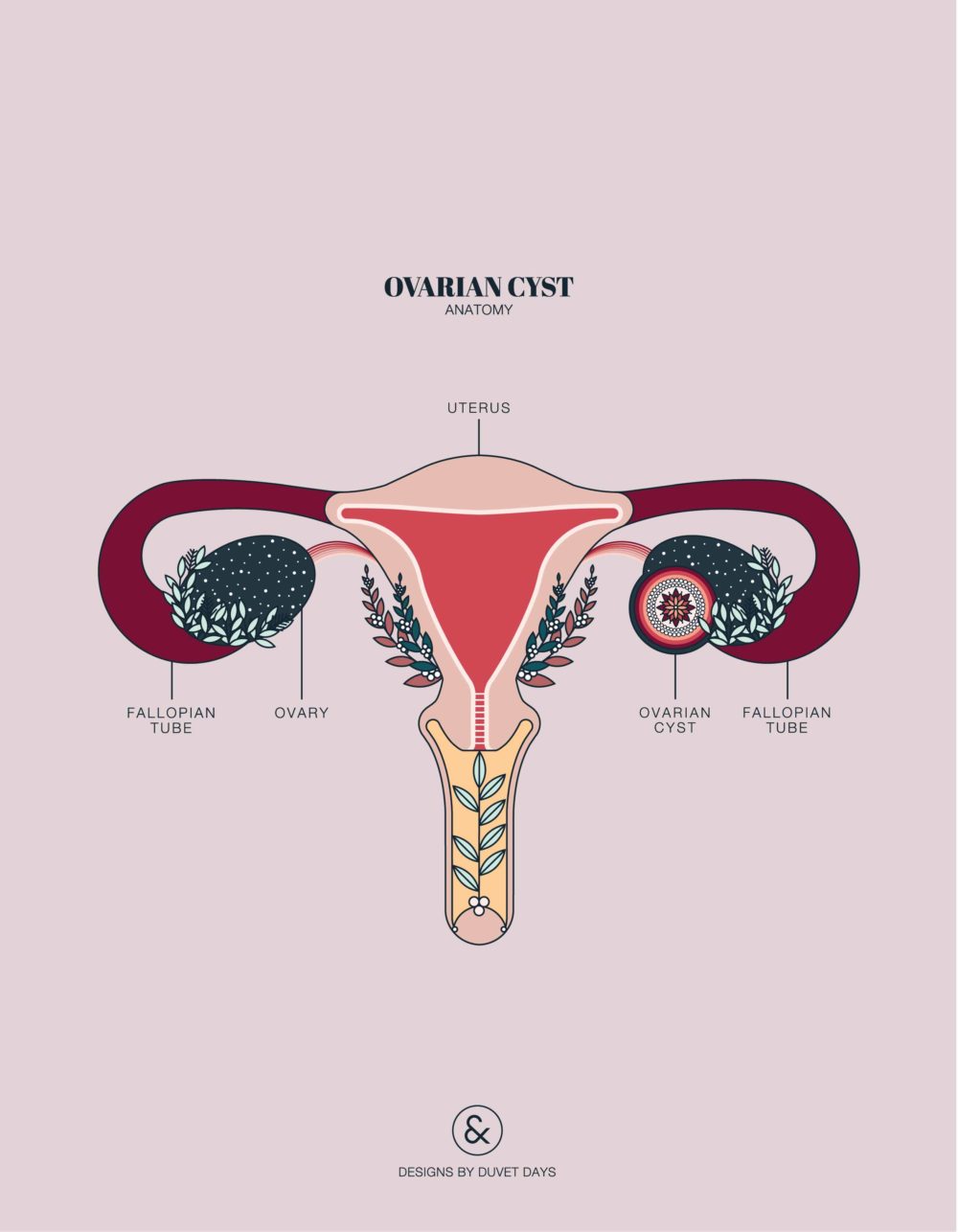 Duvet Days_Anatomy Illustrations_8.5x11_Ovarian Cyst_Preview-01