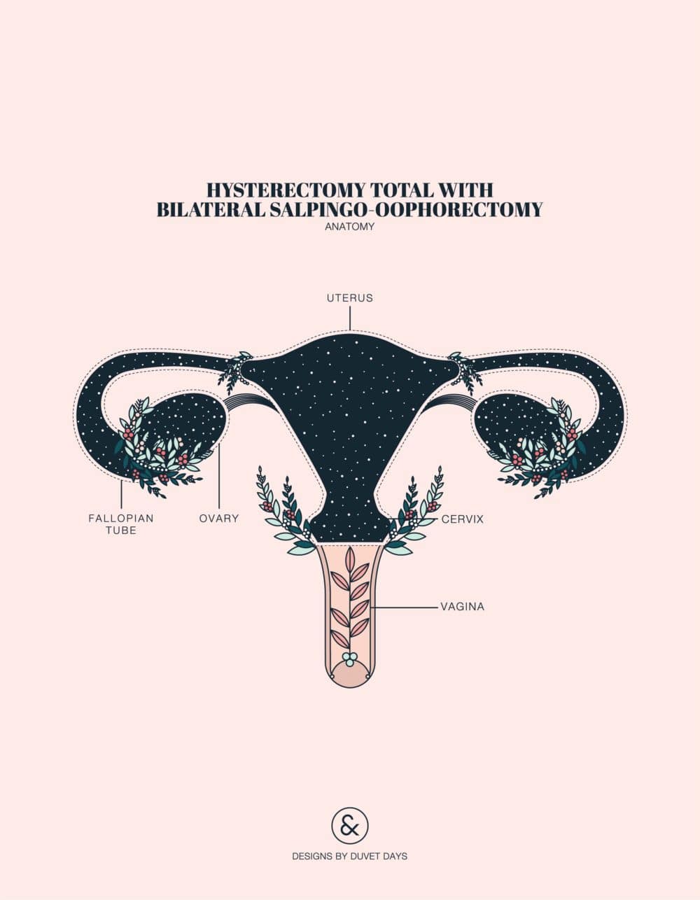 Designs By Duvet Days_8.5x11_Hysterectomy Total with Bilateral Salpingo-Oophorectomy_Preview