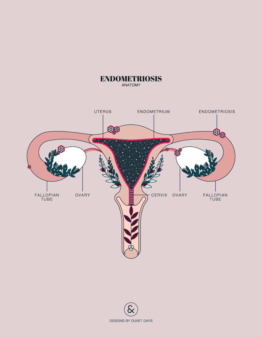 Duvet Days_Anatomy Illustrations_Endometriosis Anatomy