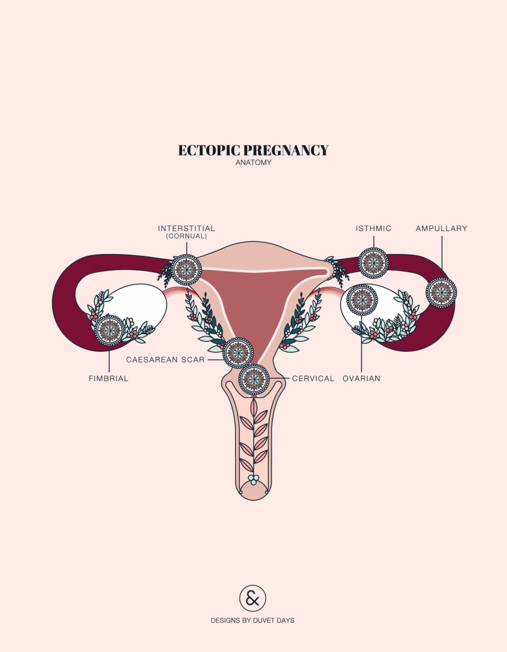 Duvet Days_Anatomy Illustrations_8.5x11_Ectopic Pregnancy_Preview-01