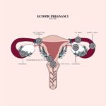 Duvet Days_Anatomy Illustrations_8.5x11_Ectopic Pregnancy_Preview-01