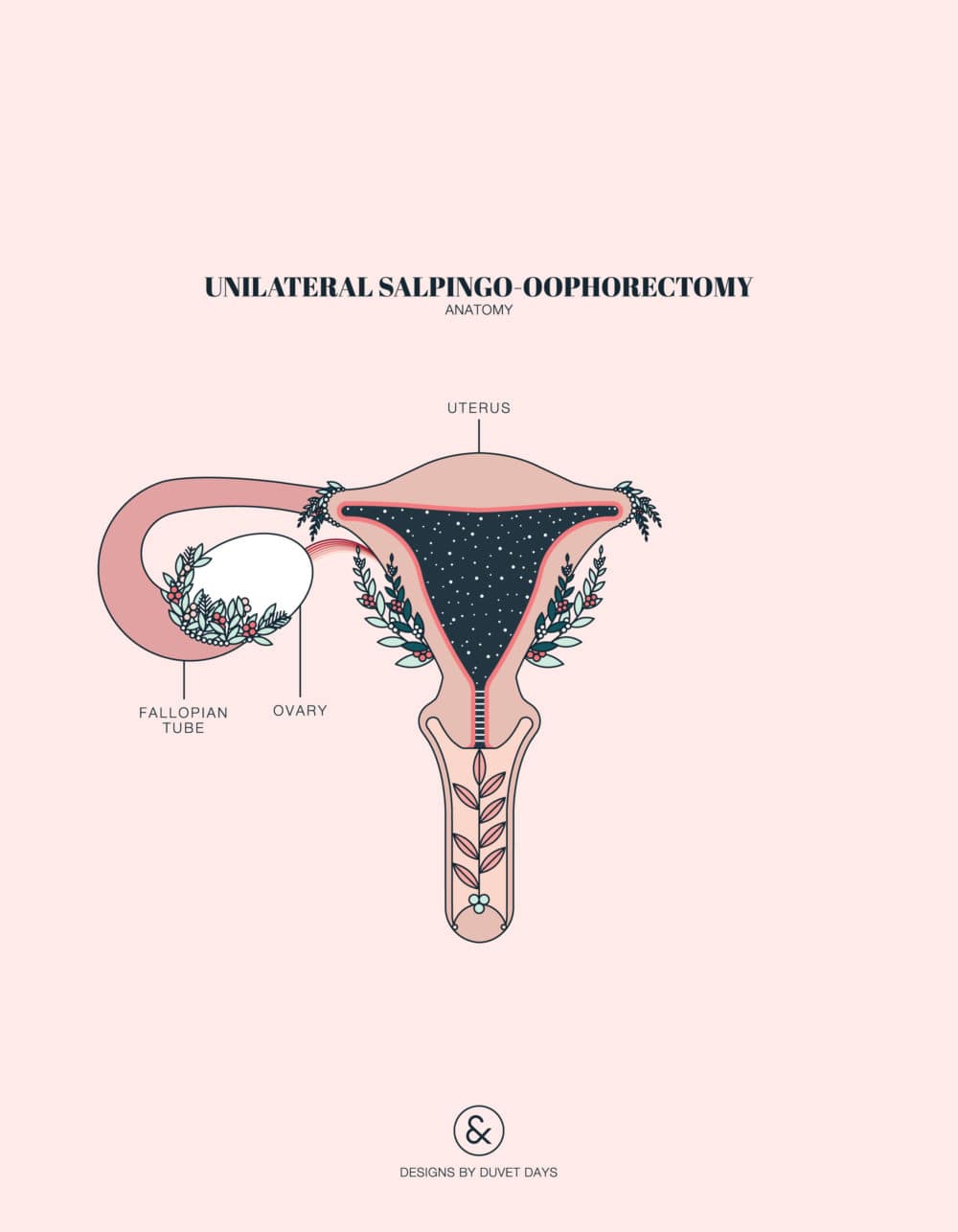 Duvet Days_Anatomy Illustrations_8.5x11_Unilateral Salpingo-Oophorectomy-09