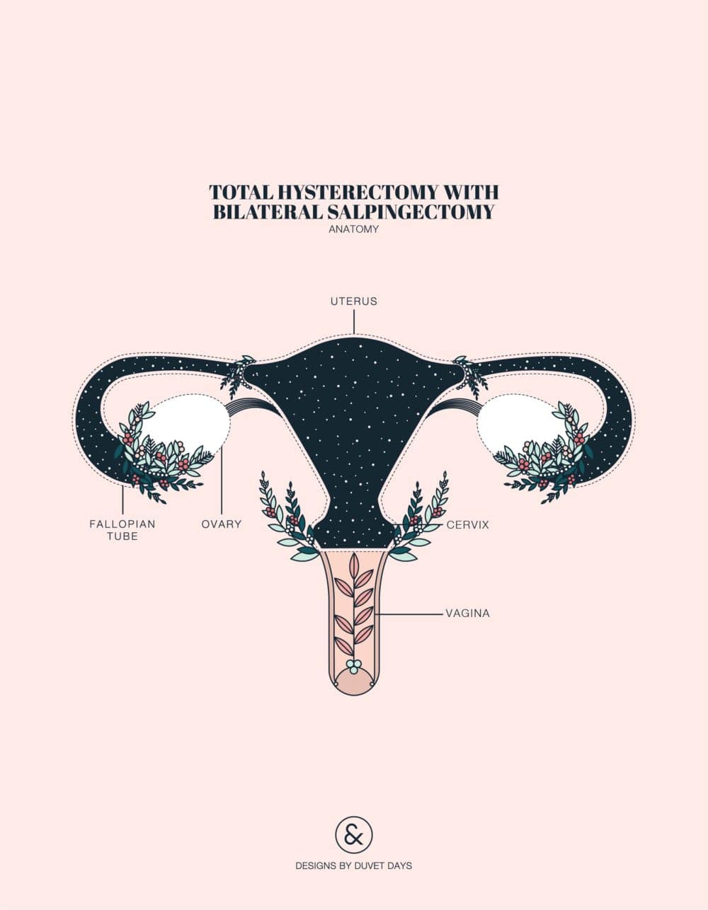 Duvet Days_Anatomy Illustrations_8.5x11_Hysterectomy Total with Bilateral Salpingectomy_Preview